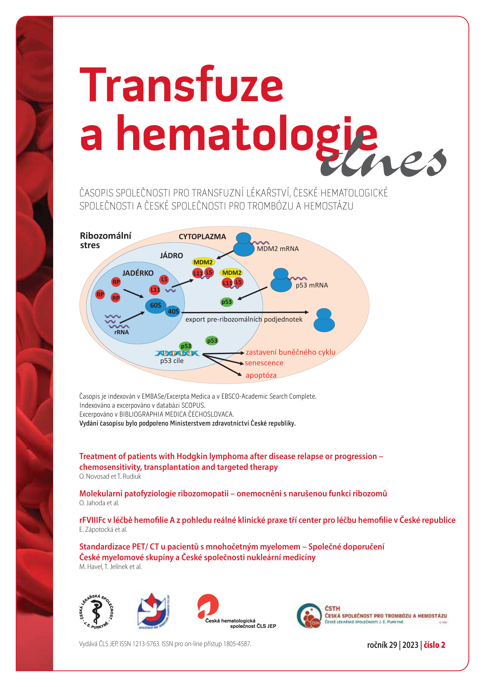 					Náhled Vol 29 No 2 (2023): Transfuze a hematologie dnes
				