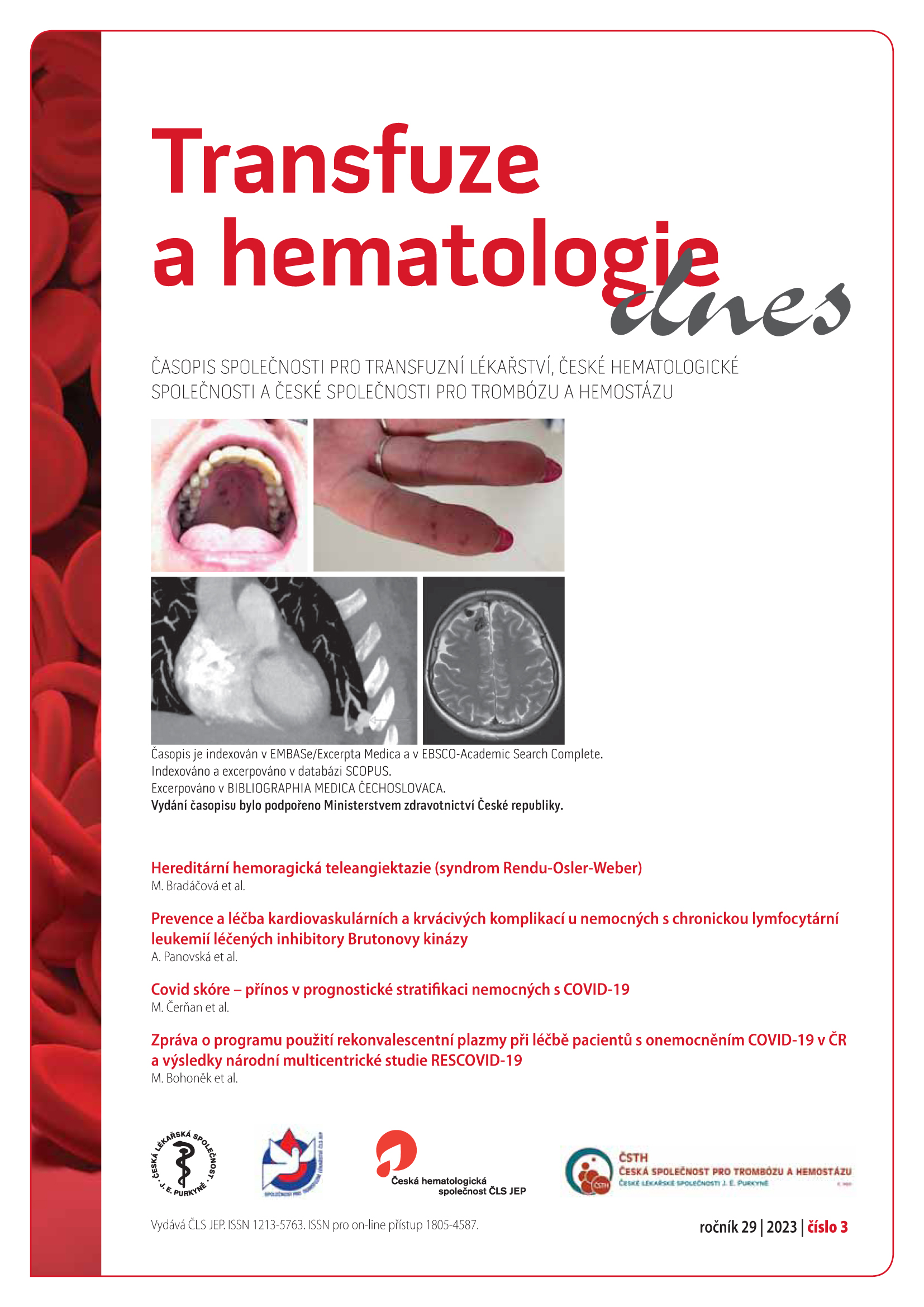 					Náhled Vol 29 No 3 (2023): Transfuze a hematologie dnes
				