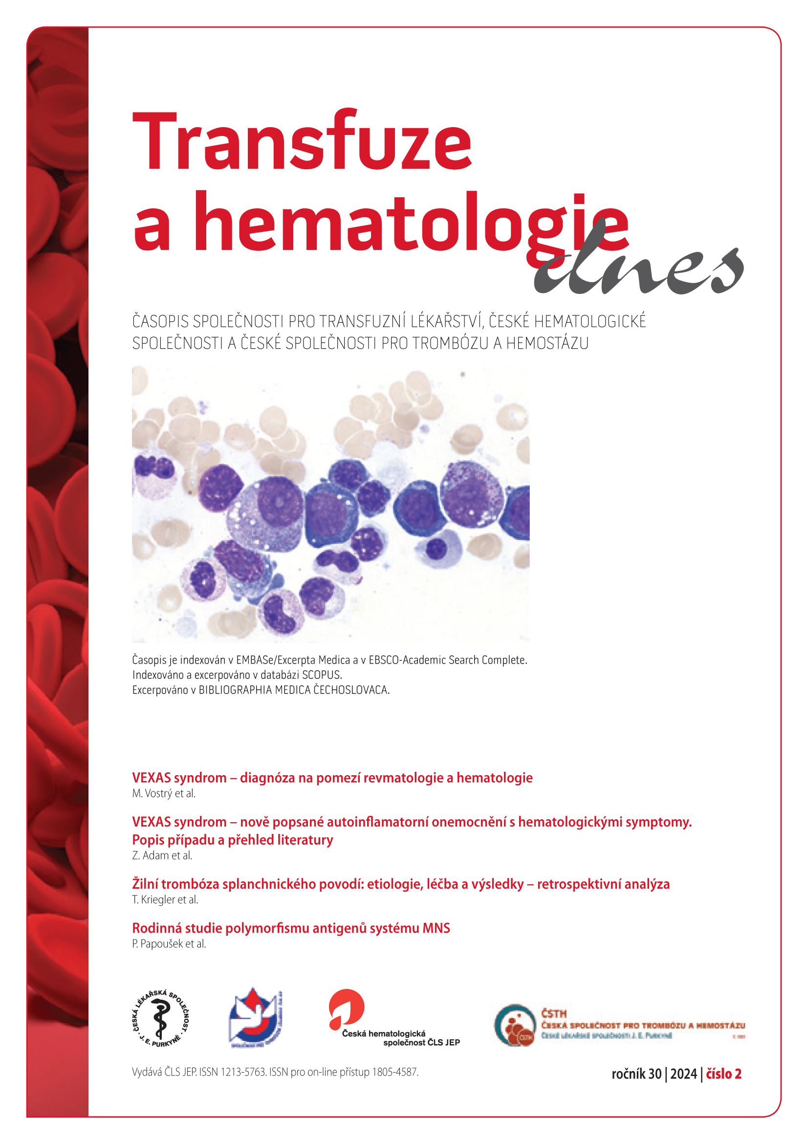 					Náhled Vol 30 No 2 (2024): Transfuze a hematologie dnes
				