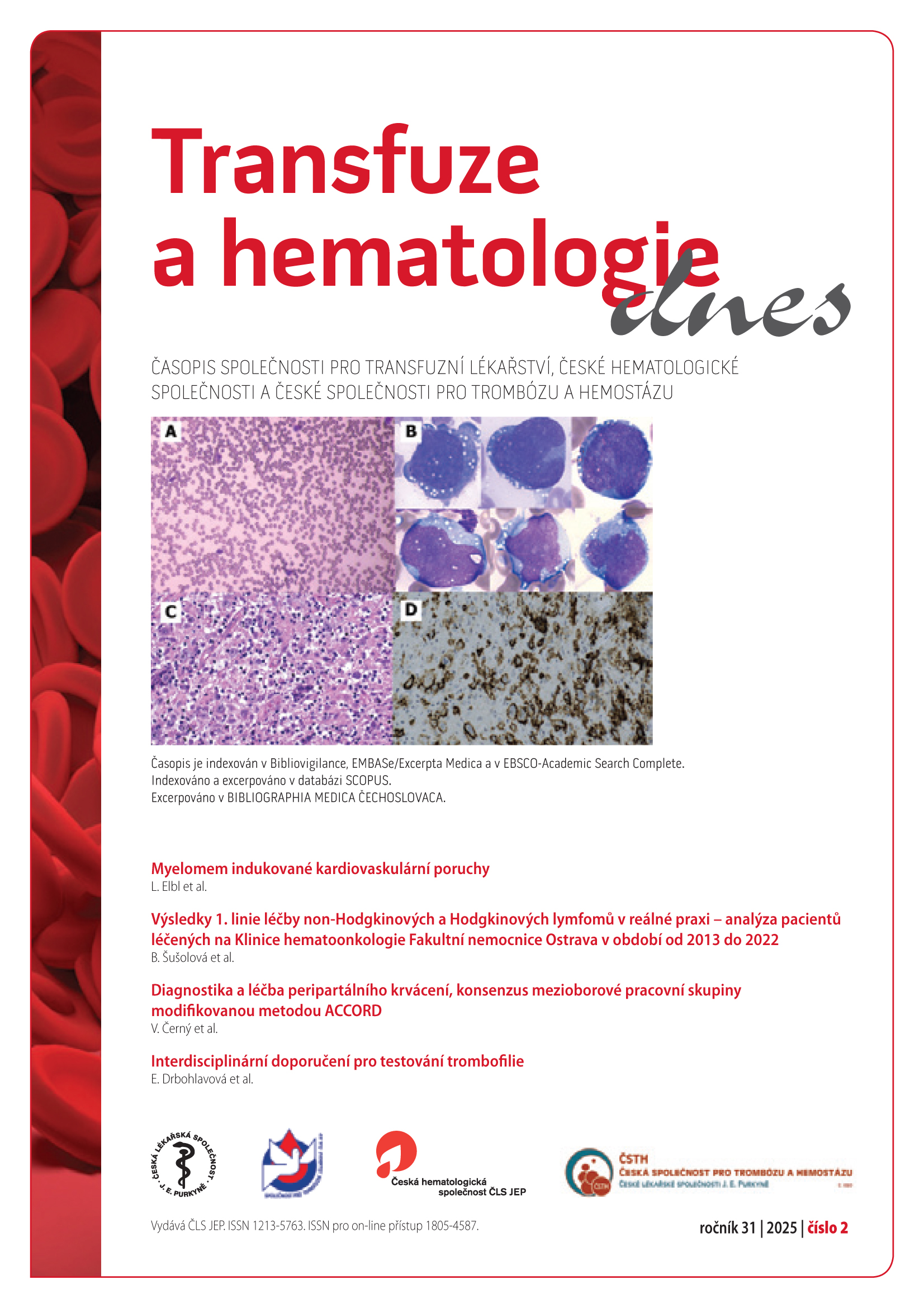 					Náhled Vol 31 No 2 (2025): Transfuze a hematologie dnes
				