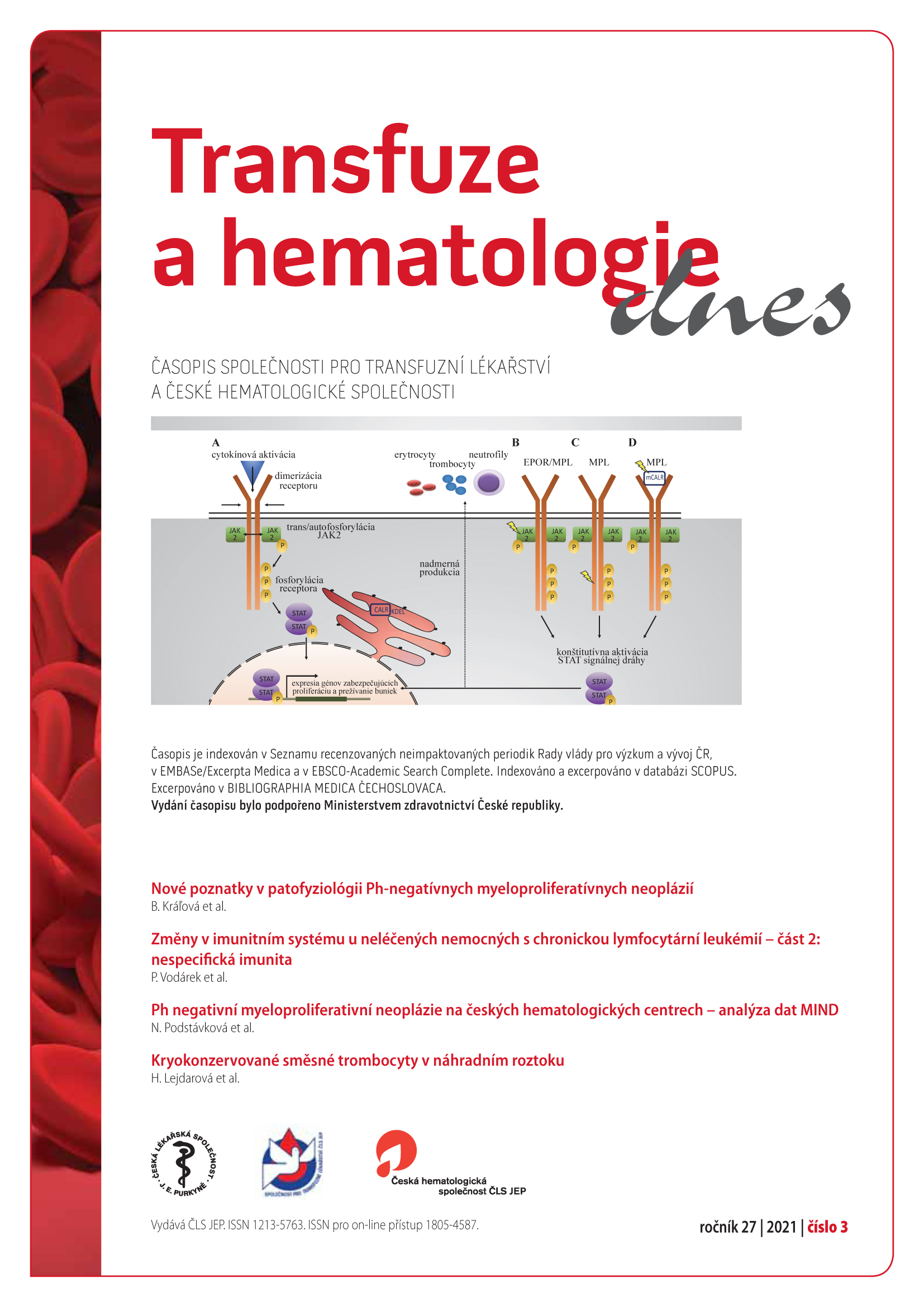 					Náhled Vol 27 No 3 (2021): Transfuze a hematologie dnes
				