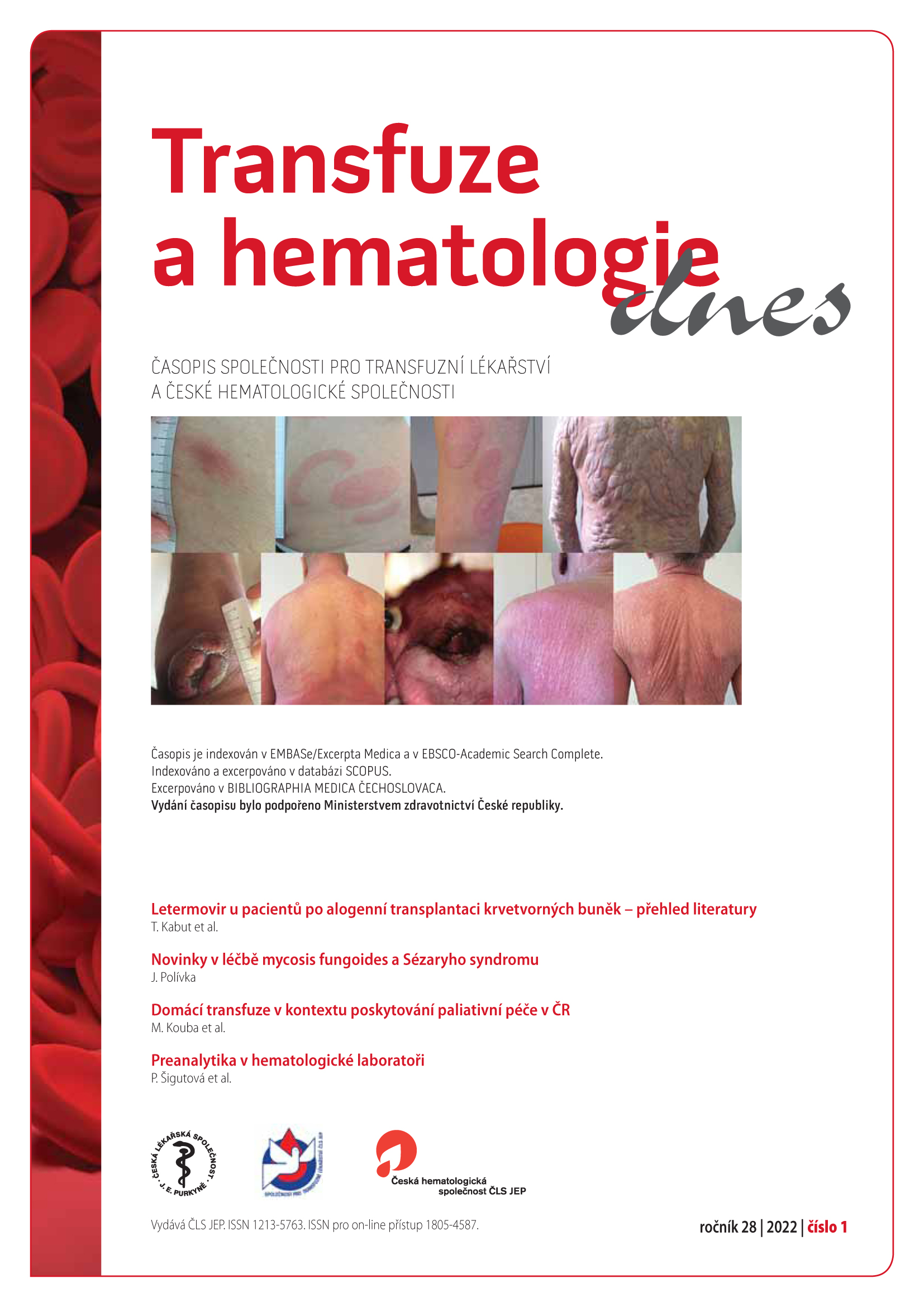 					Náhled Vol 28 No 1 (2022): Transfuze a hematologie dnes
				